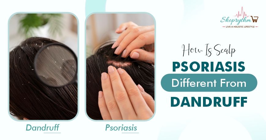 Scalp deals psoriasis brush